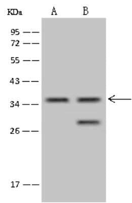 Western Blot: TSEN34 Antibody [NBP2-98554] - Anti-TSEN34 rabbit polyclonal antibody at 1:500 dilution. Lane A: HCT-116 Whole Cell Lysate Lane B: U-251 MG Whole Cell Lysate Lysates/proteins at 30 ug per lane. Secondary Goat Anti-Rabbit IgG (H+L)/HRP at 1/10000 dilution. Developed using the ECL technique. Performed under reducing conditions. Predicted band size: 34 kDa. Observed band size: 36 kDa (We are unsure as to the identity of these extra bands).
