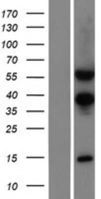 Western Blot: TSEN54 Overexpression Lysate (Adult Normal) [NBP2-04492] Left-Empty vector transfected control cell lysate (HEK293 cell lysate); Right -Over-expression Lysate for TSEN54.