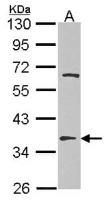 Western Blot: TSFM Antibody [NBP2-20747] - Sample (30 ug of whole cell lysate) A: Hep G2 10% SDS PAGE gel, diluted at 1:1000.