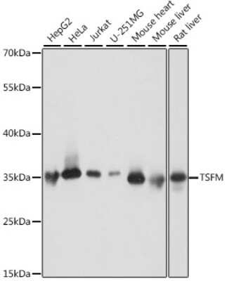 Western Blot: TSFM Antibody [NBP2-93796] - Analysis of extracts of various cell lines, using TSFM at 1:1000 dilution. Secondary antibody: HRP Goat Anti-Rabbit IgG (H+L) at 1:10000 dilution. Lysates/proteins: 25ug per lane. Blocking buffer: 3% nonfat dry milk in TBST. Detection: ECL Basic Kit . Exposure time: 1s.
