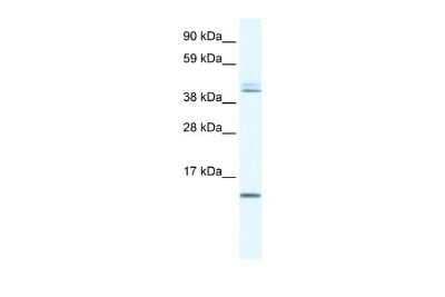 Western Blot: TSFM Antibody [NBP3-10952] - Western blot analysis of TSFM in Human Liver as a positive control. Antibody dilution at 0.2-1 ug/ml