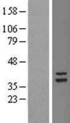 Western Blot: TSFM Overexpression Lysate (Adult Normal) [NBL1-17357] Left-Empty vector transfected control cell lysate (HEK293 cell lysate); Right -Over-expression Lysate for TSFM.