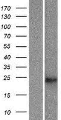 Western Blot: TSG-9 Overexpression Lysate (Native) [NBP2-08930] - TSG-9 Overexpression Lysate (Native) Left-Empty vector transfected control cell lysate (HEK293 cell lysate); Right -Over-expression Lysate for Tusc1.