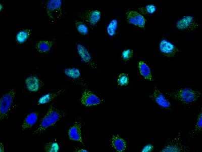 Immunocytochemistry/Immunofluorescence: TSG101 Antibody [NBP2-98994] - Immunofluorescence staining of TSG101 in HeLa cells. Cells were fixed with 4% PFA, permeabilzed with 0.3% Triton X-100 in PBS, blocked with 10% serum, and incubated with rabbit anti-human TSG101 polyclonal antibody (1:5000) at 4C overnight. Then cells were stained with the Alexa Fluor(R)488-conjugated Goat Anti-rabbit IgG secondary antibody (green) and counterstained with DAPI (blue). Positive staining was localized to cytoplasm and nucleus.