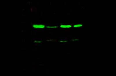 Western Blot: TSG101 Antibody [NBP2-98994] - Lane A: HeLa Whole Cell LysateLane B: A431 Whole Cell LysateLane C: Jurkat Whole Cell LysateLane D: HepG2 Whole Cell LysateLysates/proteins at 30 ug per lane.SecondaryGoat Anti- Rabbit  IgG H&L (Dylight 800)  at 1/10000 dilution.Developed using the Odyssey technique.Performed under reducing conditions.Predicted band size:43 kDaObserved band size:49 kDa(We are unsure as to the identity of these extra bands.)