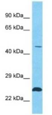 Western Blot: TSGA10IP Antibody [NBP3-09900] - Western blot analysis of TSGA10IP in HT1080 Whole Cell lysates. Antibody dilution at 1.0ug/ml