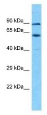 Western Blot: TSGA10IP Antibody [NBP3-09901] - Western blot analysis of TSGA10IP in Human OVCAR-3 Whole Cell. Antibody dilution at 1ug/ml