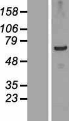 Western Blot: TSGA10IP Overexpression Lysate (Adult Normal) [NBP2-05316] Left-Empty vector transfected control cell lysate (HEK293 cell lysate); Right -Over-expression Lysate for TSGA10IP.