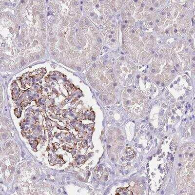 Immunohistochemistry: TSGA13 Antibody [NBP2-13488] - Staining of human kidney shows moderate membranous positivity in cells in glomeruli.