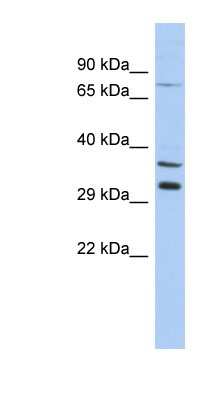Western Blot: TSGA13 Antibody [NBP1-70739] - THP-1 cell lysate, concentration 0.2-1 ug/ml.