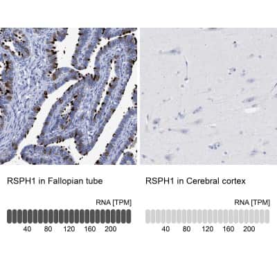 Immunohistochemistry-Paraffin TSGA2 Antibody - BSA Free