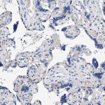 Immunohistochemistry-Paraffin: TSGA2 Antibody [NBP1-89839] - Staining of human placenta shows no positivity in trophoblastic cells as expected.