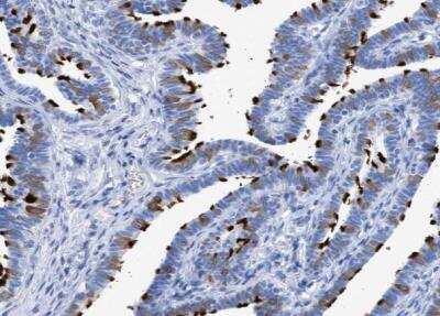 Immunohistochemistry-Paraffin: TSGA2 Antibody [NBP1-89840] - Staining of human fallopian tube shows strong positivity in cilia glandular cells.
