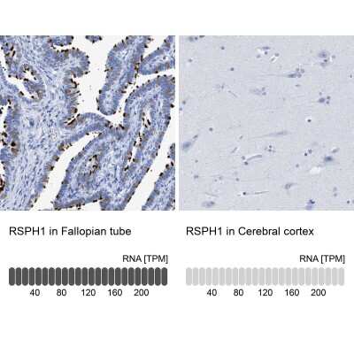 <b>Orthogonal Strategies Validation. </b>Immunohistochemistry-Paraffin: TSGA2 Antibody [NBP1-89840] - Analysis in human fallopian tube and cerebral cortex tissues using NBP1-89840 antibody. Corresponding RSPH1 RNA-seq data are presented for the same tissues.