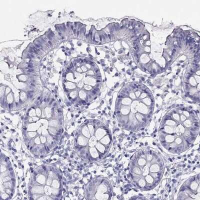 Immunohistochemistry-Paraffin: TSH beta Antibody [NBP2-68647] - Staining of human lower gastrointestinal shows no positivity in glandular cells as expected.