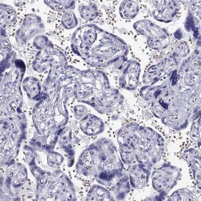 Immunohistochemistry-Paraffin: TSH beta Antibody [NBP2-68647] - Staining of human placenta shows no positivity in trophoblastic cells as expected.