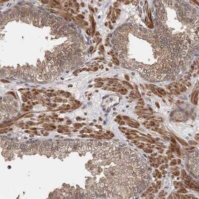 Immunohistochemistry-Paraffin: TSHZ2 Antibody [NBP1-88303] - Staining of human prostate shows strong nuclear positivity in smooth muscle cells.