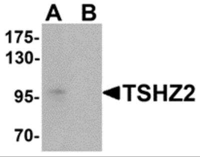 Western Blot TSHZ2 Antibody - BSA Free