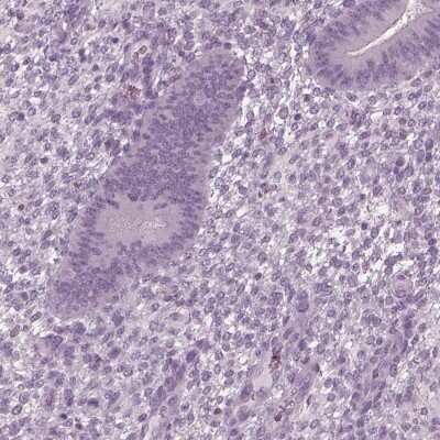 <b>Orthogonal Strategies Validation. </b>Immunohistochemistry-Paraffin: TSKS Antibody [NBP1-92539] - Staining of human endometrium shows low expression as expected.