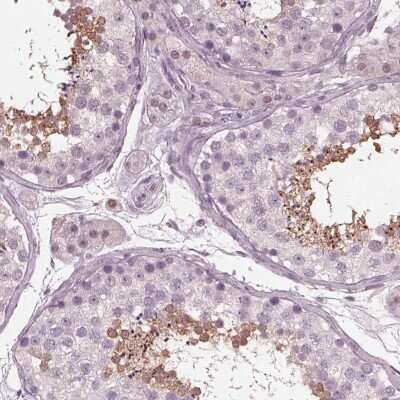 Immunohistochemistry-Paraffin: TSKS Antibody [NBP1-92539] - Staining of human testis shows high expression.