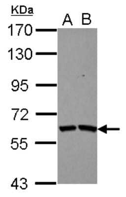 Western Blot: TSKS Antibody [NBP2-20749] - Sample (30 ug of whole cell lysate) A: IMR32 B: U87-MG 7. 5% SDS PAGE gel, diluted at 1:1000.