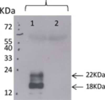 Western Blot: TSLP Antibody (210H1.04) [DDX0804P-100] - Analysis using the Biotin conjugate of DDX0804P-100. Detection of TSLP in 1) transfected 293T and 2) untransfected 293T cells using DDX0804.