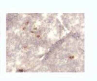 Immunohistochemistry: TSLP Antibody (214E4.01) [DDX0800P-100] - Staining of human tonsil frozen section.