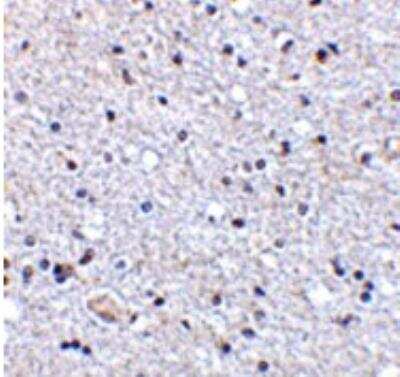 Immunohistochemistry-Paraffin: TSLP Antibody [NB110-55234] - Human brain tissue with TSLP antibody at 2.5 ug/mL.