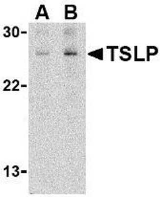 <b>Expression of Tagged Proteins Validation. </b>Western Blot: TSLP Antibody [NB110-55233] - Jurkat cell lysate with TSLP antibody at (A) 1 and (B) 2 ug/ml.