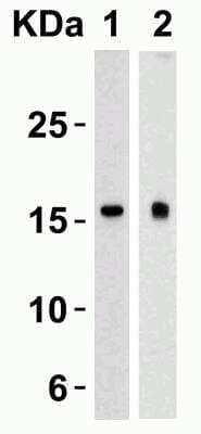 Western Blot: TSLP Antibody [NB110-55234] - Western Blot Validation in Human Heart (Lane 1) and Human Prostate (Lane 2).Loading: 15 ug of lysates per lane. Antibodies: TSLP NB110-55234 (4 ug/mL), 1h incubation at RT in 5% NFDM/TBST. Secondary: Goat anti-rabbit IgG HRP conjugate at 1:10000 dilution.