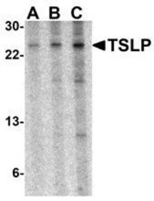 Western Blot: TSLP Antibody [NBP1-76754] - A-20 cell lysate with TSLP antibody at (A) 0.5, (B) 1 and (C) 2 ug/ml.