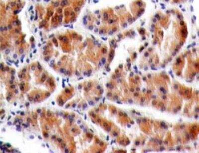 Immunohistochemistry-Paraffin: TSLP R/CRLF2 Antibody (59N5G4) [NBP2-27331] - Formalin-fixed, paraffin-embedded normal human kidney tissue stained with TSLPR antibody (5 ug/ml), peroxidase-conjugate and DAB chromogen.