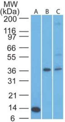 Western Blot: TSLP R/CRLF2 Antibody (59N5G4) [NBP2-27331] - Analysis of CRLF2 in an A) partial recombinant protein (0.1 ug/ml), B) human muscle and C) liver lysate (5 ug/ml) using CRLF2 antibody.