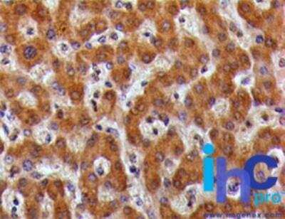 Immunohistochemistry-Paraffin: TSLP R/CRLF2 Antibody [NBP2-22383] -  Formalin-fixed, paraffin-embedded normal human liver tissue (IMH-343) stained with CRLF2 antibody (5 ug/ml), peroxidase-conjugate and DAB chromogen.