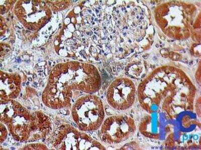 Immunohistochemistry-Paraffin: TSLP R/CRLF2 Antibody [NBP2-22384] - Paraffin-embedded normal human kidney tissue stained with TSLPR antibody (5 ug/ml), peroxidase-conjugate and DAB chromogen.