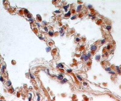 Immunohistochemistry-Paraffin: TSLP R/CRLF2 Antibody [NBP2-27288] - Formalin-fixed, paraffin-embedded normal human lung tissue stained with TSLP receptor antibody (5 ug/ml), peroxidase-conjugate and DAB chromogen.