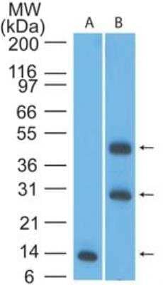 Western Blot: TSLP R/CRLF2 Antibody [NBP2-22384] - Analysis of TSLPR in an A) partial recombinant protein (0.1 ug/ml) and B) human liver lysate (2ug/ml) using TSLPR antibody.