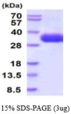 SDS-Page: Recombinant Human TSLP R/CRLF2 Protein [NBP2-53075] -  15% SDS-PAGE (3ug)