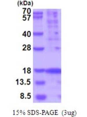 SDS-Page: Recombinant Human TSLP Protein [NBP2-51957] - 15% SDS Page (3 ug)