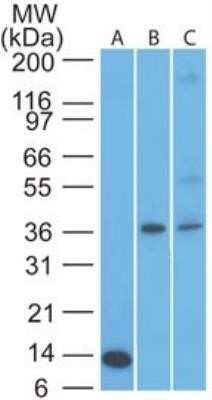 Western Blot: TSLPR/CRLF2 Antibody (59N5G4) - Azide and BSA Free [NBP2-81000] - Analysis of CRLF2 in an A) partial recombinant protein (0.1 ug/ml), B) human muscle and C) liver lysate (5 ug/ml) using CRLF2 antibody. Image from the standard format of this antibody.