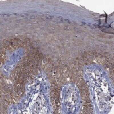 Immunohistochemistry-Paraffin TSNARE1 Antibody