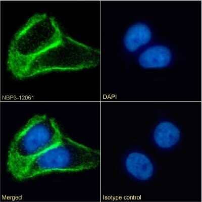 Immunocytochemistry/Immunofluorescence: TSPAN1 Antibody (4/12) - Chimeric [NBP3-12061] - Immunofluorescence analysis of paraformaldehyde fixed A431 cells on Shi-fix(TM) coverslips stained with the chimeric rabbit IgG version 4/12 (NBP3-12061) at 10 ug/ml for 1h followed by Alexa Fluor(R) 488 secondary antibody (2 ug/ml), showing membrane staining. The nuclear stain is DAPI (blue). Panels show from left-right, top-bottom NBP3-12061, DAPI, merged channels and an isotype control. The isotype control was an unknown specificity antibody followed by staining with Alexa Fluor(R) 488 secondary antibody.