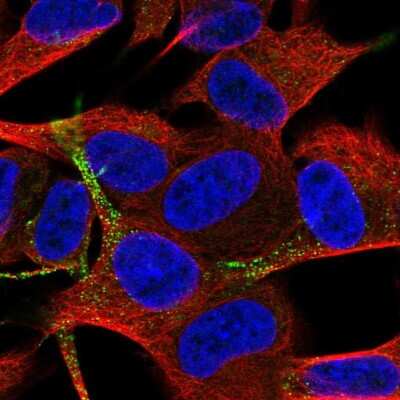 Immunocytochemistry/Immunofluorescence: TSPAN11 Antibody [NBP2-57481] - Staining of human cell line SH-SY5Y shows localization to vesicles. Antibody staining is shown in green.