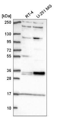 Western Blot: TSPAN11 Antibody [NBP2-57481] - Analysis in human cell line RT-4 and human cell line U-251 MG.