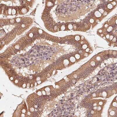 Immunohistochemistry-Paraffin: TSPAN12 Antibody [NBP2-49278] - Staining of human small intestine shows membrane positivity in glandular cells.