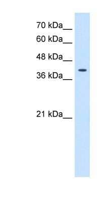 Western Blot: TSPAN12 Antibody [NBP1-91297] - HepG2 cell lysate, concentration 0.2-1 ug/ml.
