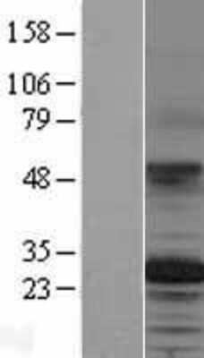 Western Blot: TSPAN12 Overexpression Lysate (Adult Normal) [NBP2-04335] Left-Empty vector transfected control cell lysate (HEK293 cell lysate); Right -Over-expression Lysate for TSPAN12.