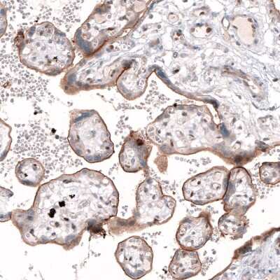 Immunohistochemistry-Paraffin TSPAN13 Antibody