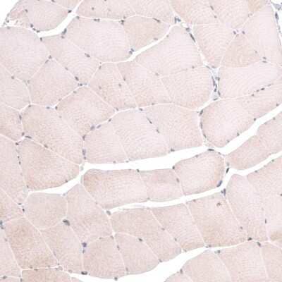 Immunohistochemistry-Paraffin TSPAN13 Antibody