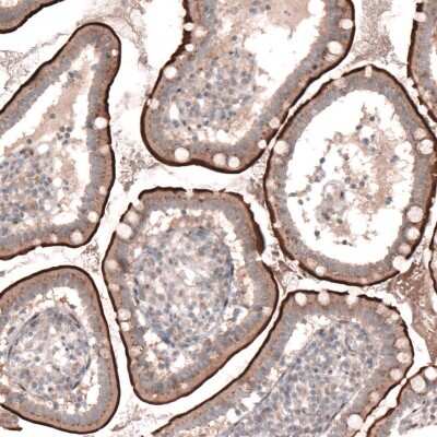 Immunohistochemistry-Paraffin TSPAN13 Antibody